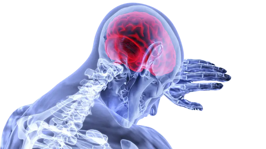 Illustration of Stroke showing brain inflammation